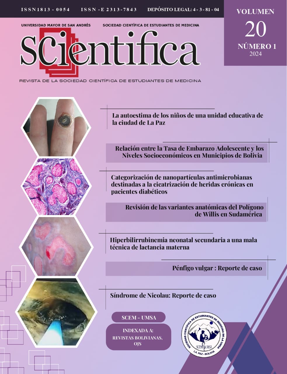 					Ver Vol. 20 Núm. 1 (2024): Revista Scientifica 
				
